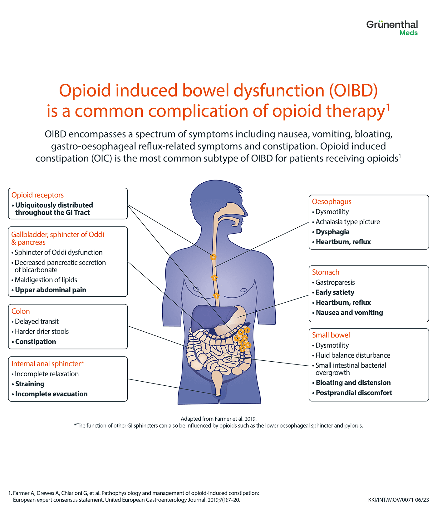 Labelled image of a human body showing that opioid induced bowel dysfunction encompasses a range of symptoms and is a common complication of opioid therapy