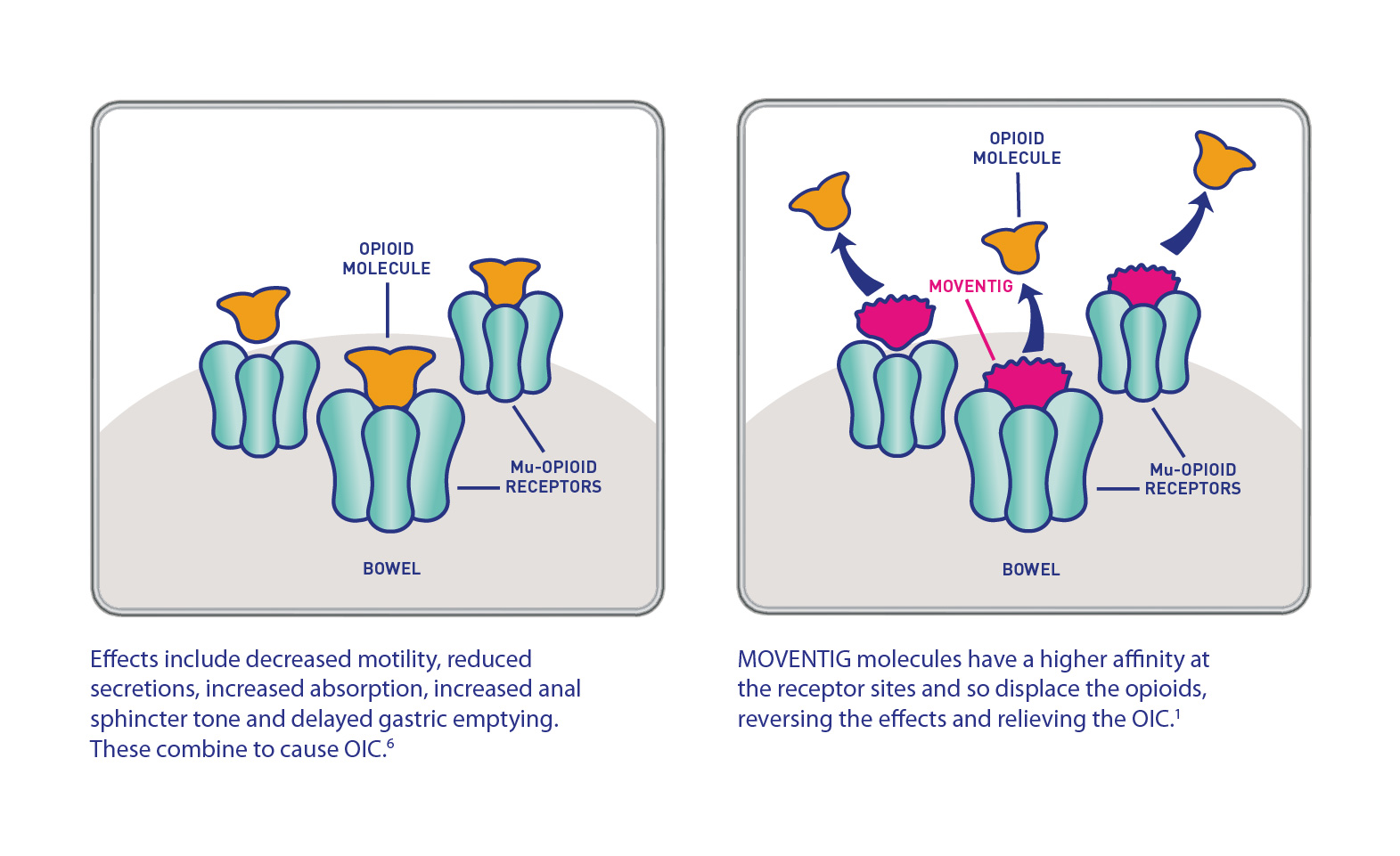 signs and symptoms of OIC
