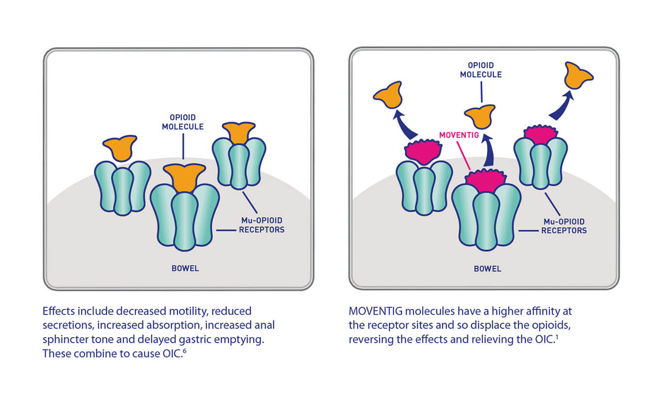 Diagram of how Moventig (naloxegol) displaces opioids and binds to mu-opioid receptors